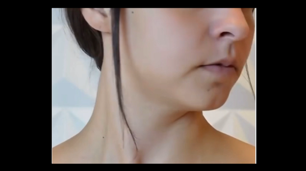 Before treatment