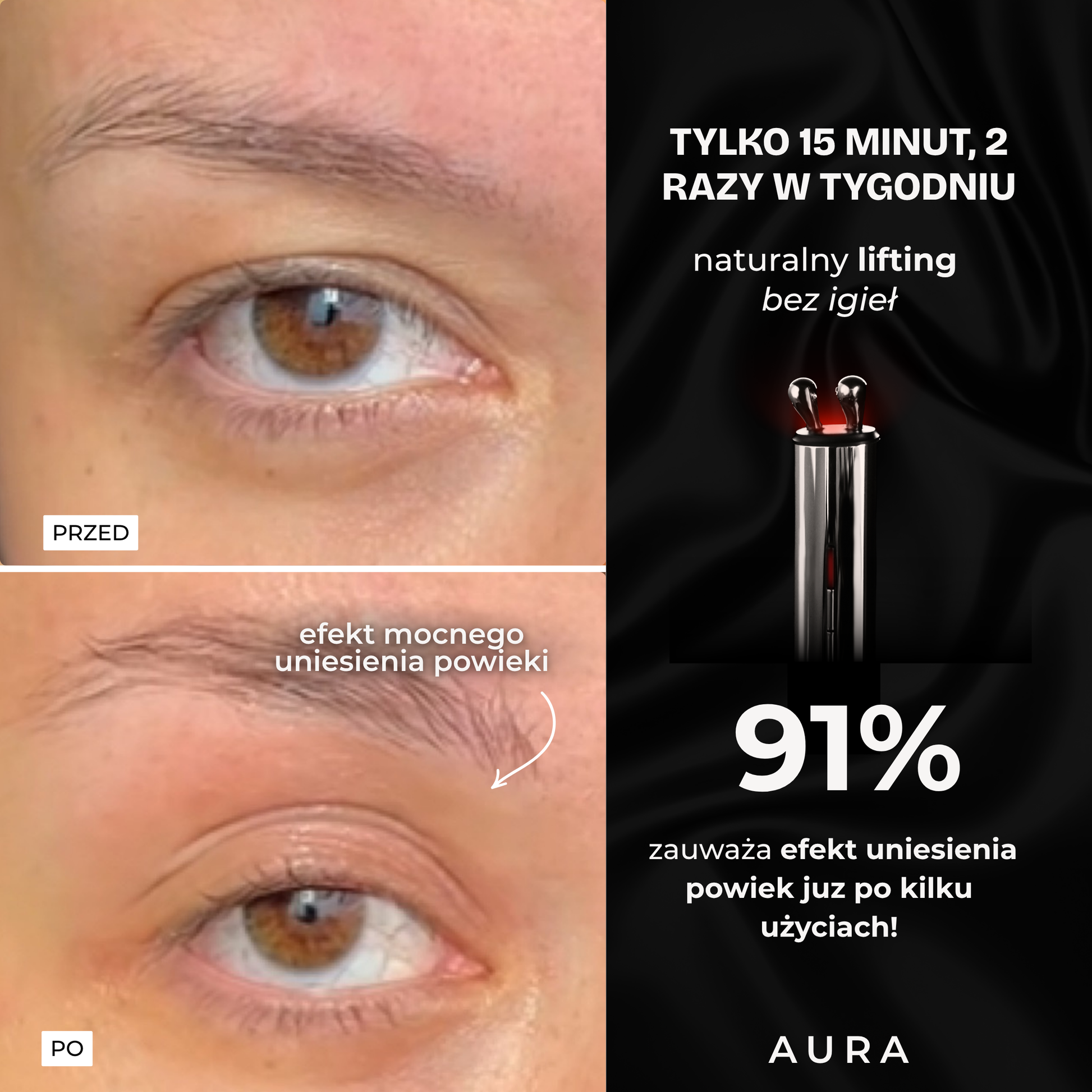 AURA RF masażer liftingujący, booster kolagenu z RF i LED