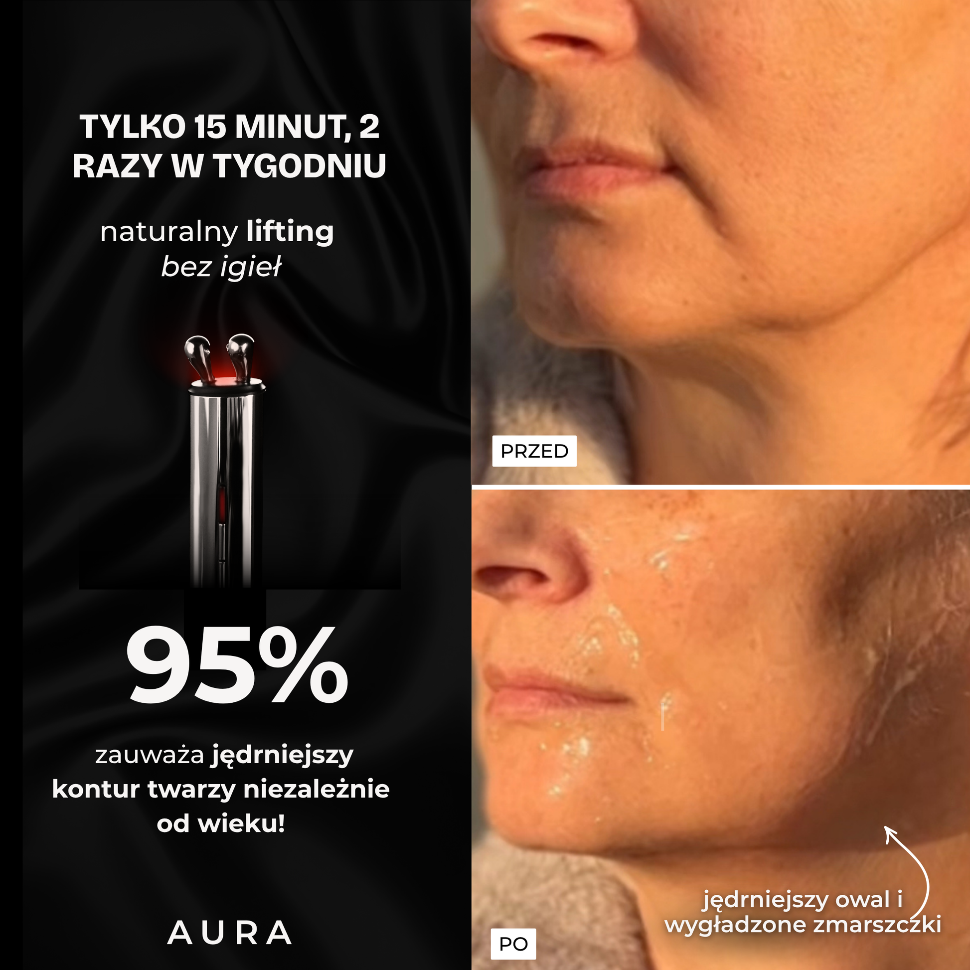 AURA RF masażer liftingujący, booster kolagenu z RF i LED