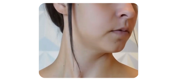 Before treatment
